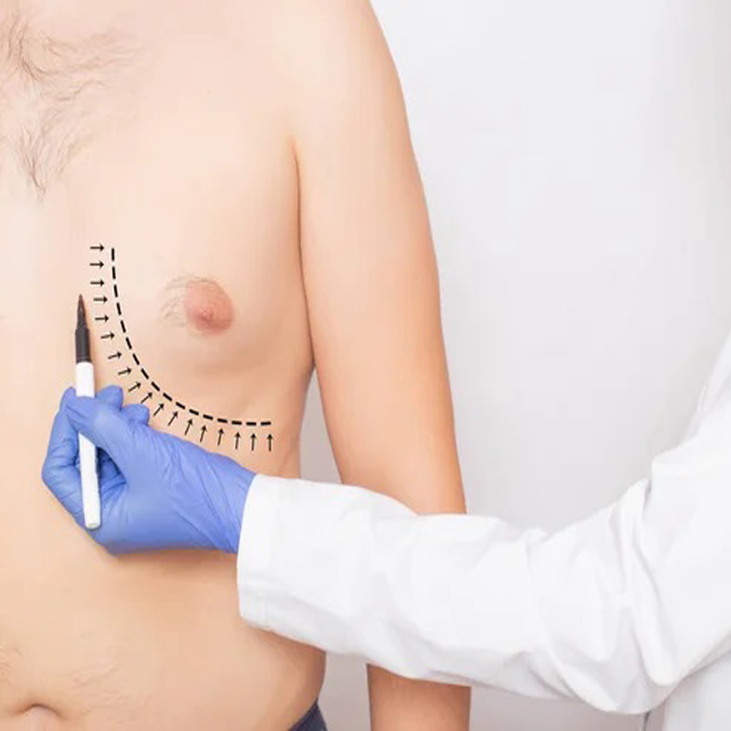 Resultados de cirugía plástica estética en Clínica Alonso de Córdoba