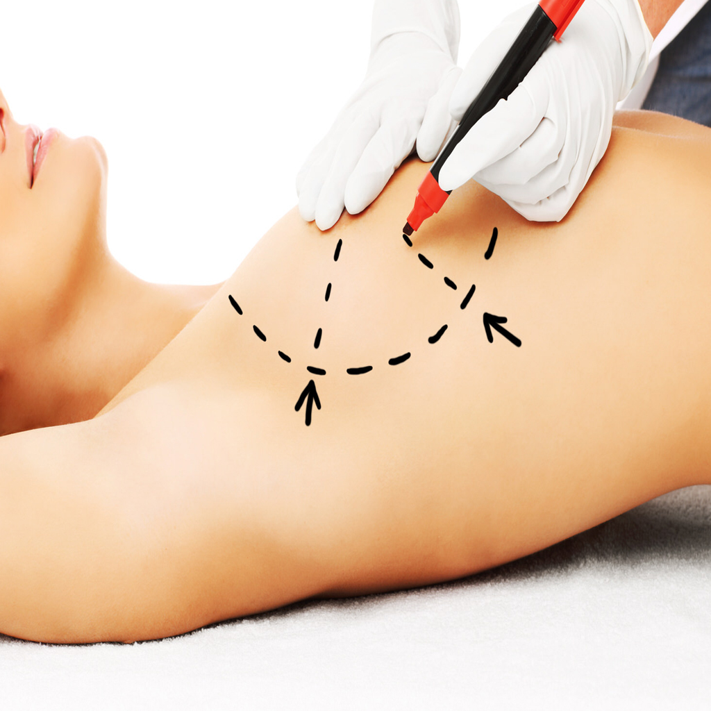 Paciente después de cirugía estética con resultados naturales