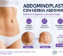 Abdminoplastia con hernia abdominal 90x80
